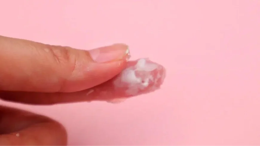 How to Get Rid of a Yeast Infection in 24 Hours